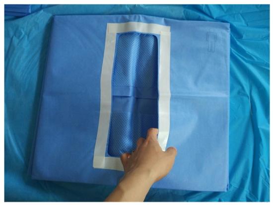 CE Bersertifikat Penjualan Panas Disposable Steril Non-woven Laparotomy Tirai Untuk Penggunaan Medis
